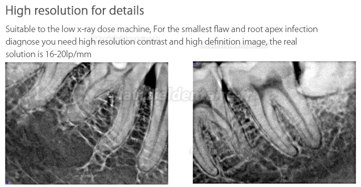 Handy HDR-600 Capteur intra-oral pour radiographie dentaire système d'imagerie numérique